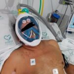 Covid: giovani di Visionari progettano valvola salvavita adottata da ospedali brasiliani